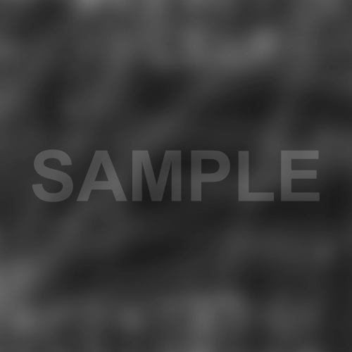 CNC Precision Tolerances in Medical Parts